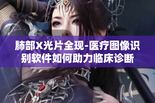 肺部X光片全现-医疗图像识别软件如何助力临床诊断